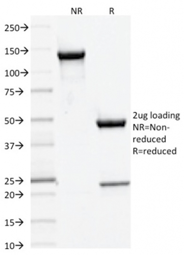 Data from SDS-PAGE analysis of Anti-DNMT3A antibody (Clone PCRP-DNMT3A-1E2). Reducing lane (R) shows heavy and light chain fragments. NR lane shows intact antibody with expected MW of approximately 150 kDa. The data are consistent with a high purity, intact mAb.